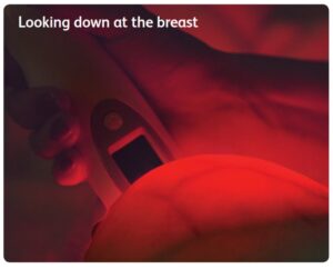 تشخیص زودهنگام سرطان سینه با BreastLight؛ فناوری نوین تصویربرداری نوری